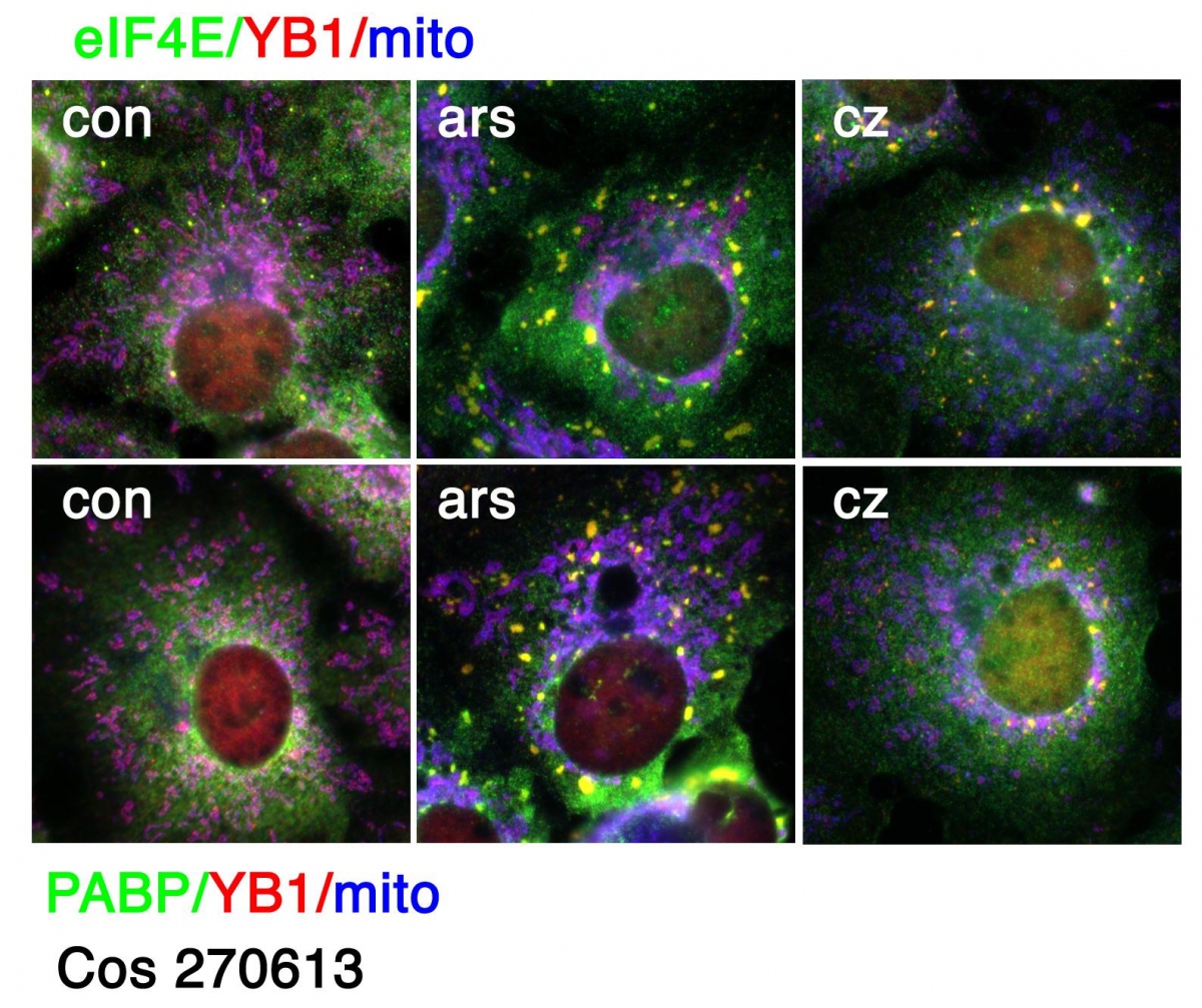 Research, eIF4E/YB1/mito